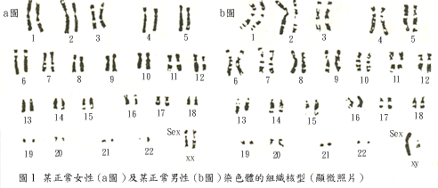 chromosome_1.GIF (21244 bytes)