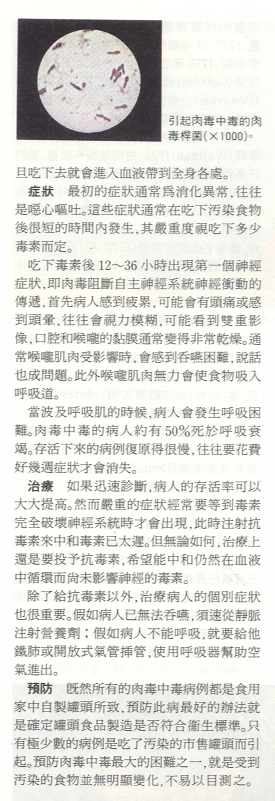 肉毒桿菌-2.jpg (897698 bytes)